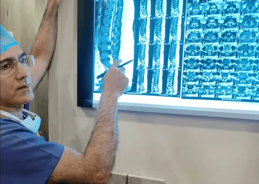 Endoscopic Spine Surgery