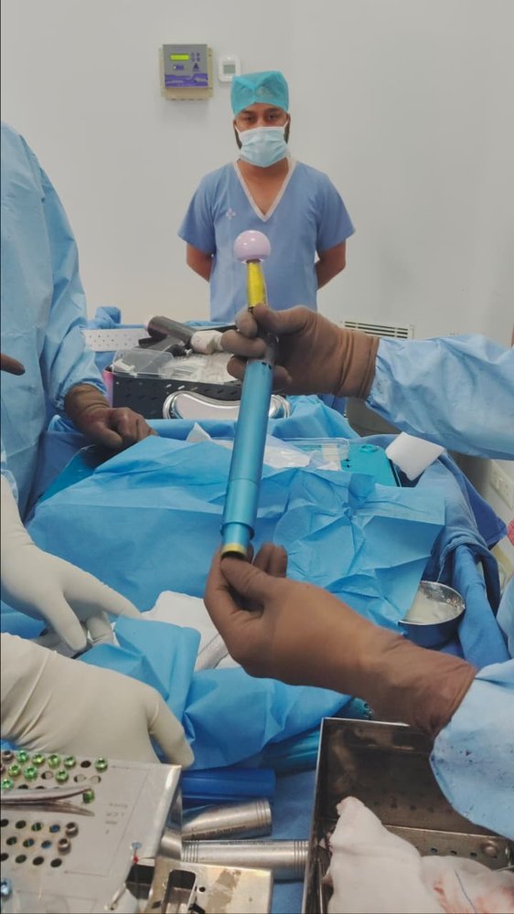 Ceramic femoral head and stem impactor used during minimally invasive hip replacement by Dr. Ashwani Maichand