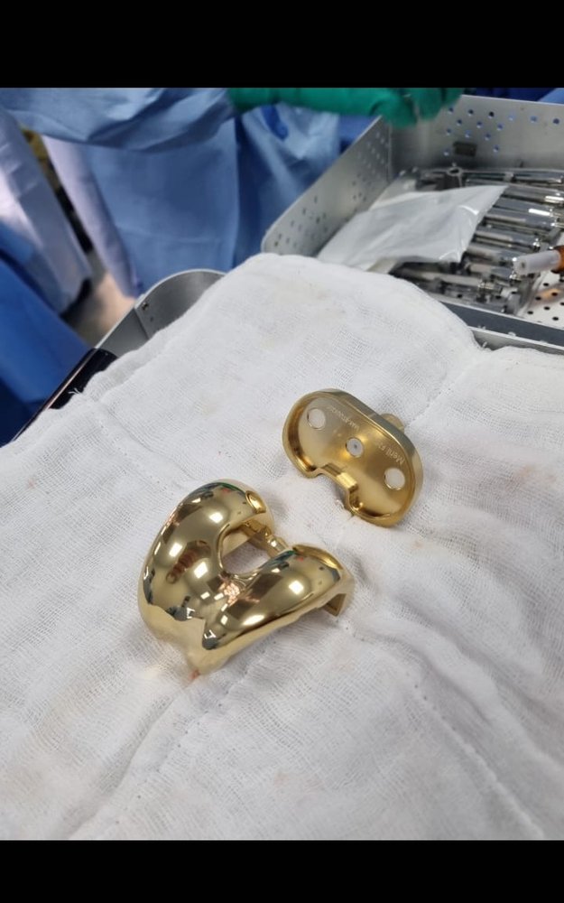 Gold-coloured femoral components of a total knee replacement implant