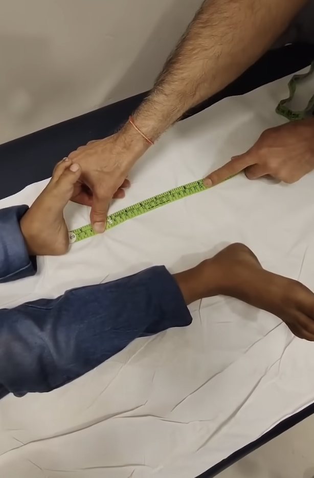 Clinical measurement of leg length discrepancy