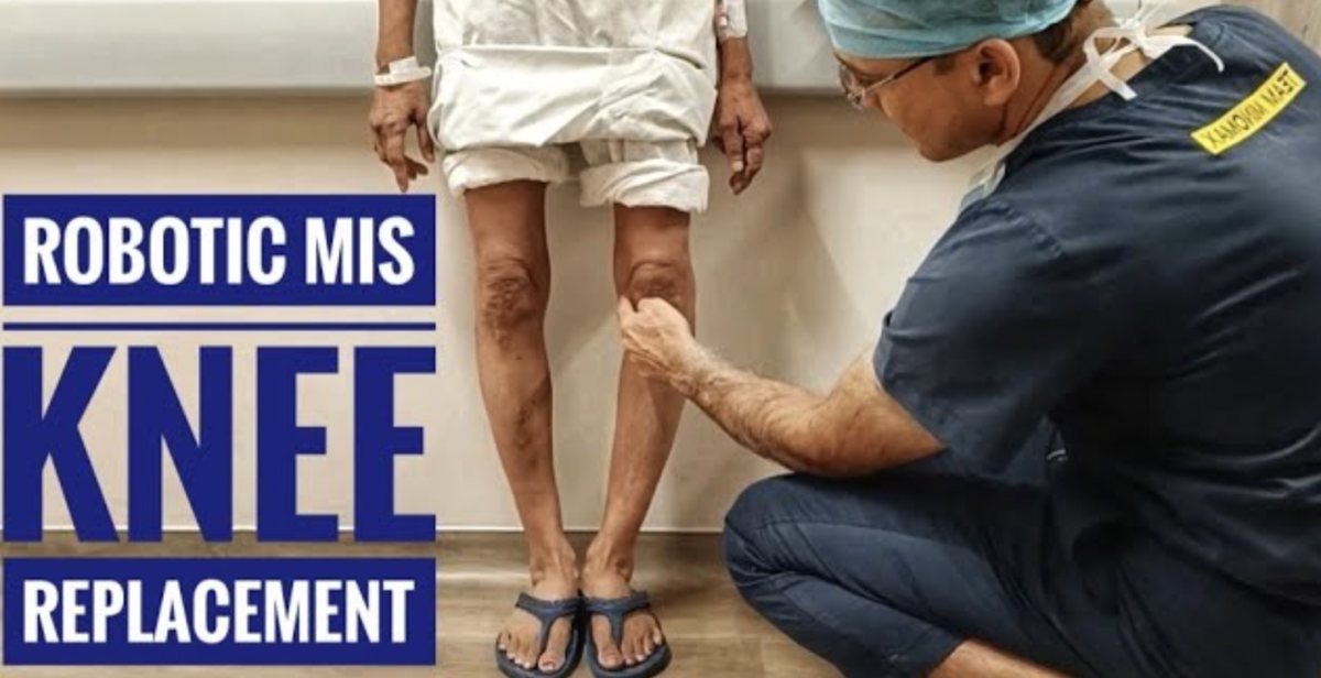 Robotic MIS knee replacement follow-up by Dr. Ashwani Maichand