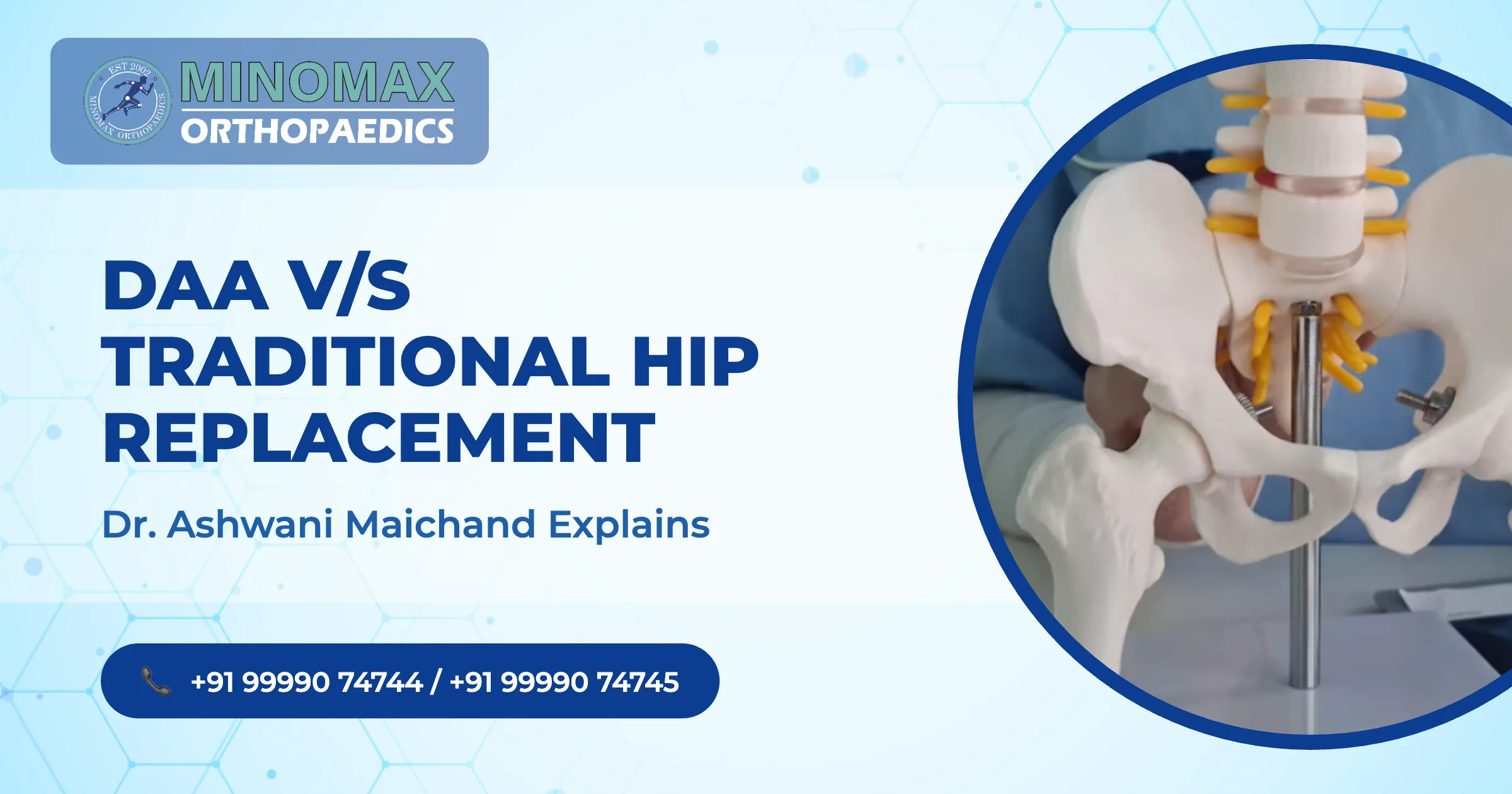 DAA v/s Traditional Hip Replacement: Dr. Ashwani Maichand
