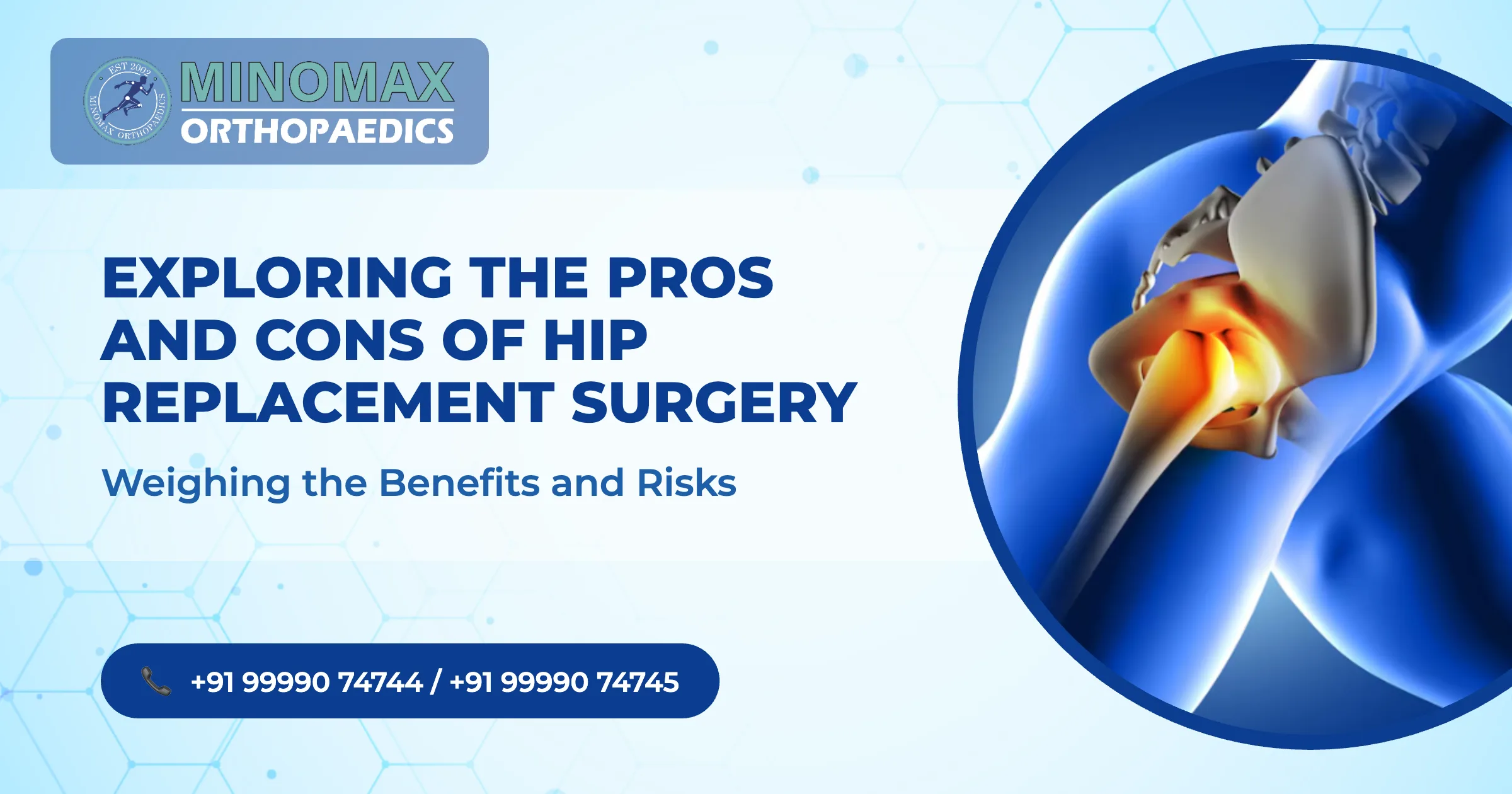 Exploring the Pros and Cons of Hip Replacement Surgery: Weighing the Benefits and Risks