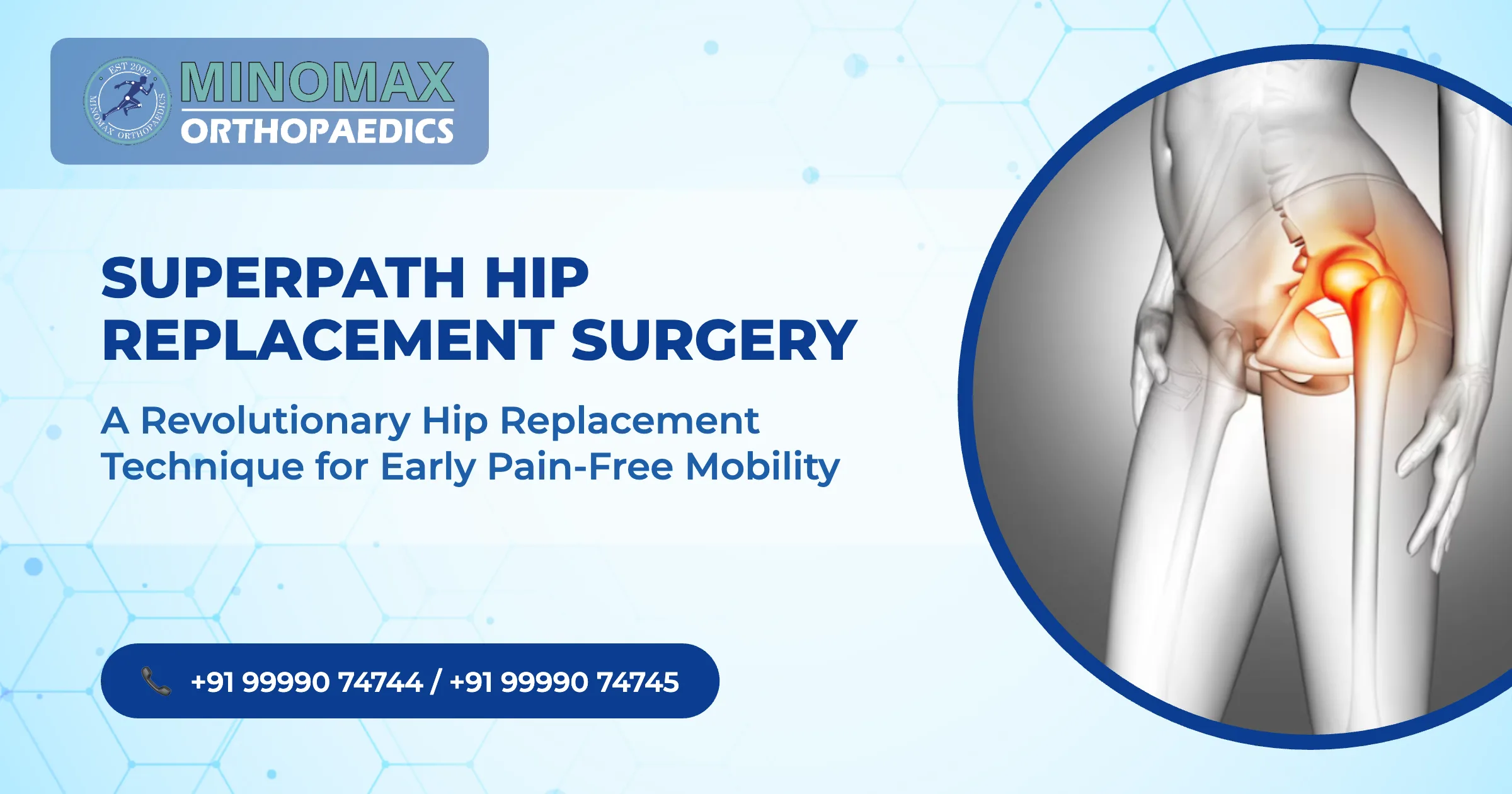 SuperPath: A Revolutionary Hip Replacement Technique for Early Pain-Free Mobility