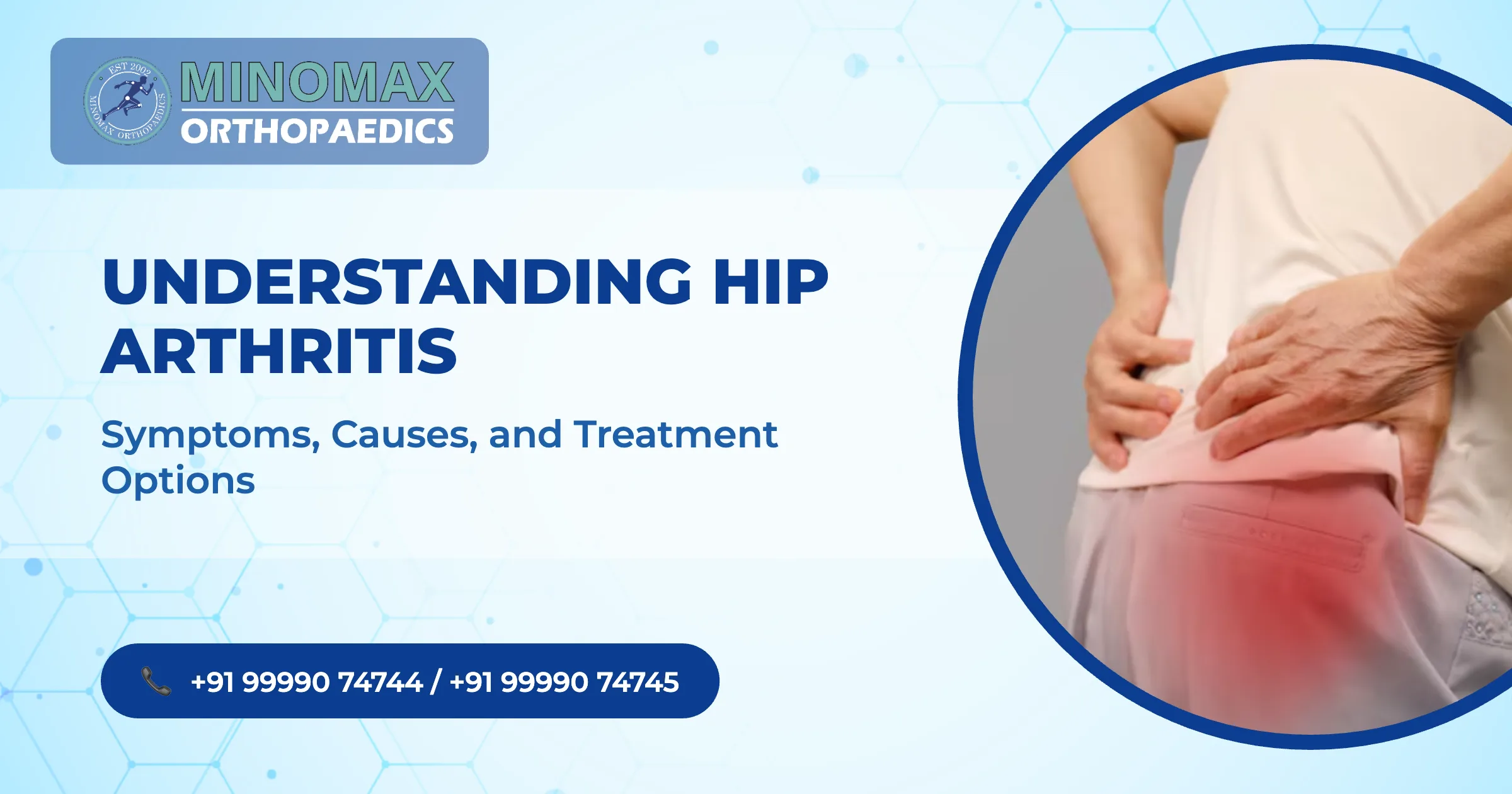 Understanding Hip Arthritis: Symptoms, Causes, and Treatment Options