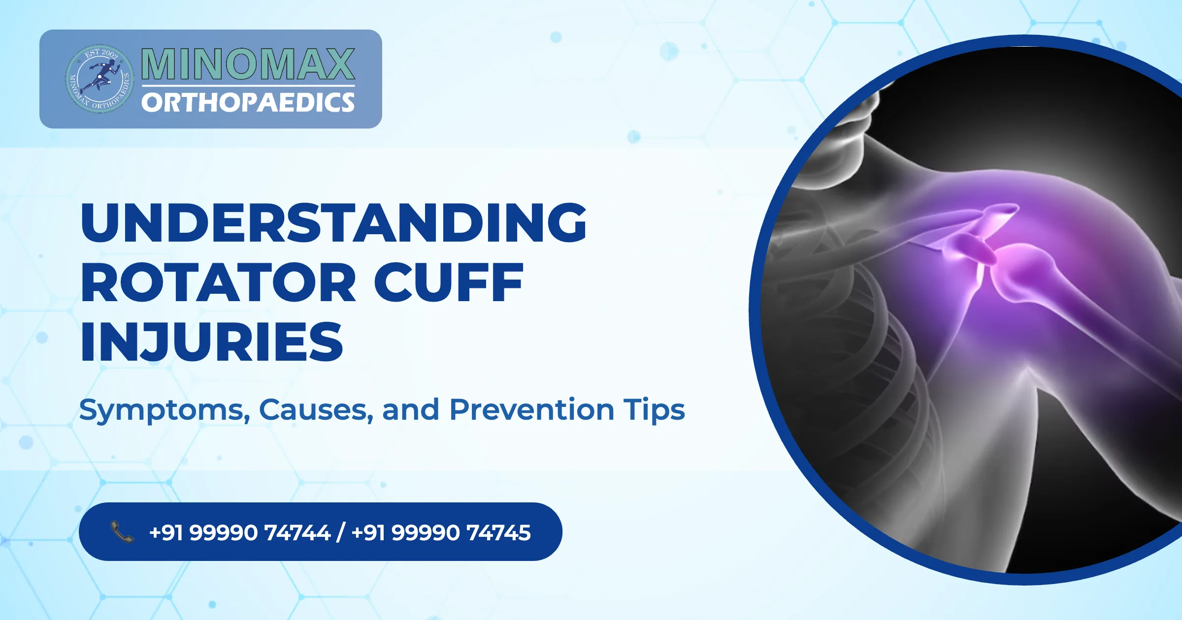 Understanding Rotator Cuff Injuries: Symptoms, Causes, and Prevention Tips